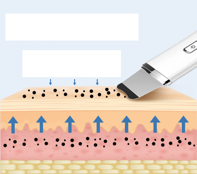 Beauty Pore Cleaning New Skin Shovel